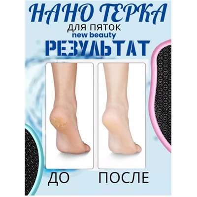 Пемза для ног нового поколения,НАНО Терка для пяток СИРЕНЕВАЯ