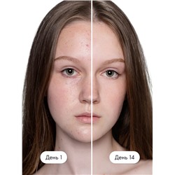 Гель для умывания для проблемной кожи SEMILY против акне, очищающий, 200 мл