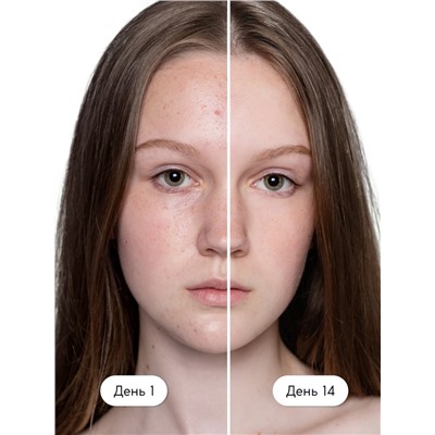 Гель для умывания для проблемной кожи SEMILY против акне, очищающий, 200 мл