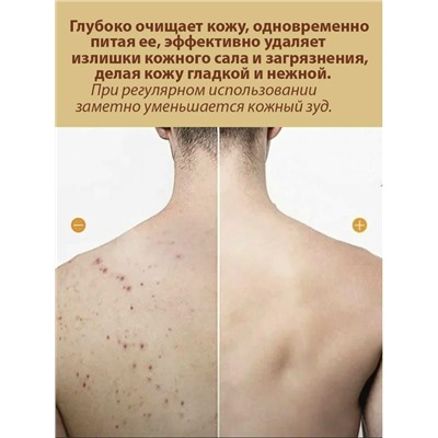 Гели для душа для глубокой очистки и увлажнения с серной водой из скважины, снимает зуд, подходят для всех типов кожи 400мл