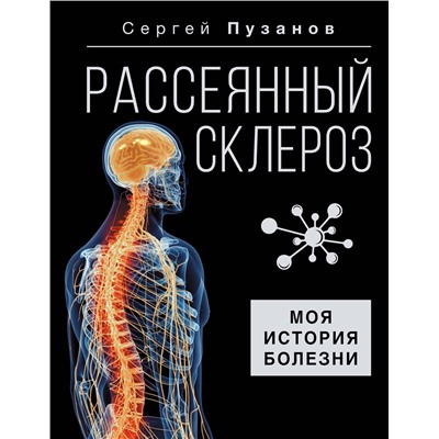 АСТ Сергей Пузанов "Рассеянный склероз. Моя история болезни"