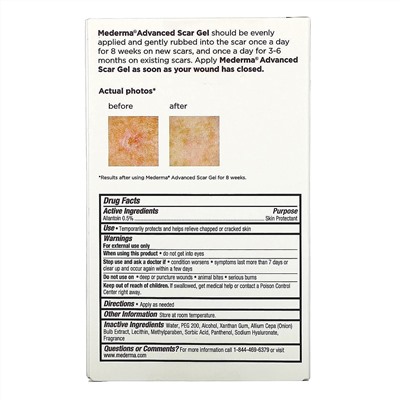 Mederma, Гель от шрамов,  1,76 унц. (50 г)