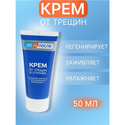Крем для ног от трещин в ступнях, «До и После», 50 мл