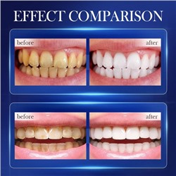 SADOER  Отбеливающая зубная паста сода, 300 гр