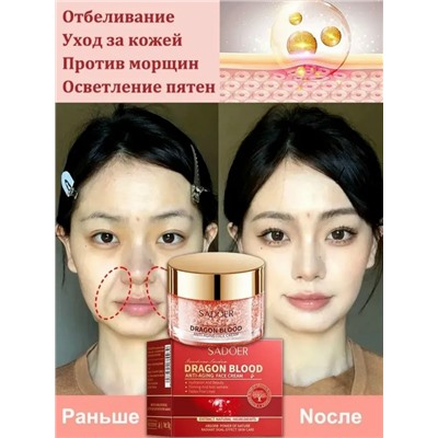 Крем для удаления веснушек #23080139