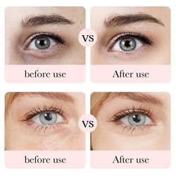 Крем для кожи вокруг глаз с Розой и Гиалуроновой кислотой Bioaqua, 20 гр.