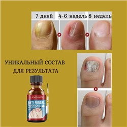 Масло лак для ногтей ,паронихия,грибок,вросшийся ноготь полное восстановление ногтя 10мл