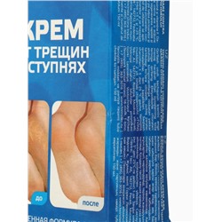 УЦЕНКА Крем для ног «До и После» от трещин в ступнях, 150 мл