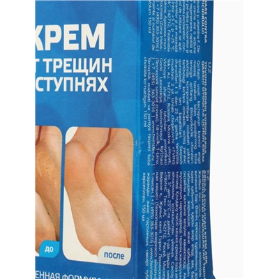 УЦЕНКА Крем для ног «До и После» от трещин в ступнях, 150 мл