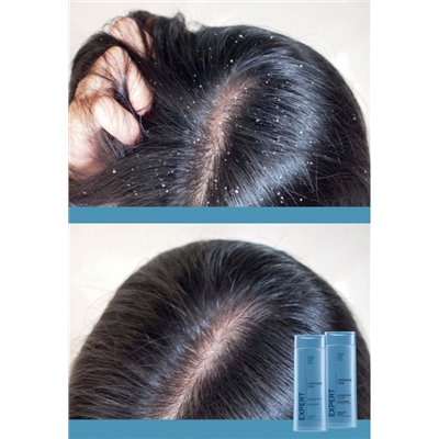 Шампунь против перхоти Expert Hair Advanced Care