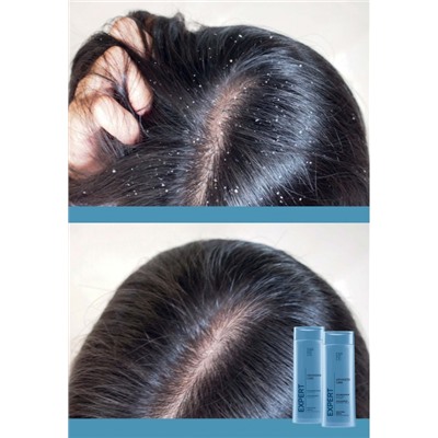 Шампунь-бальзам против перхоти 2 в 1 Expert Hair Advanced Care