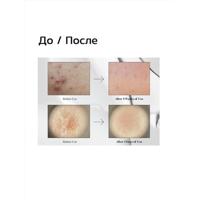 VT Cosmetics Мягкая бустер-сыворотка с микроиглами для гладкой и сияющей кожи / Midl Reedle Shot 50, 50 мл