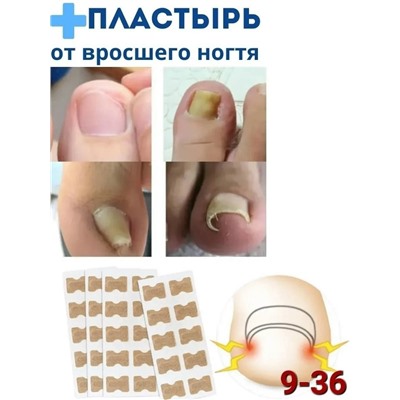 Пластырь от вросшего ногтя и грибка #23034961