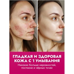 Пенка для умывания отшелушивающая SEMILY с кислотами, 150 мл