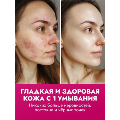 Пенка для умывания отшелушивающая SEMILY с кислотами, 150 мл