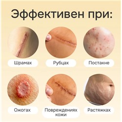 Крем от шрамов и рубцов, постакне, растяжек с маслом змеи 20гр