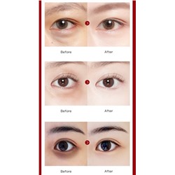 Гидрогелевые патчи для глаз с пептидом змеиного яда Jomtam, 60 шт.