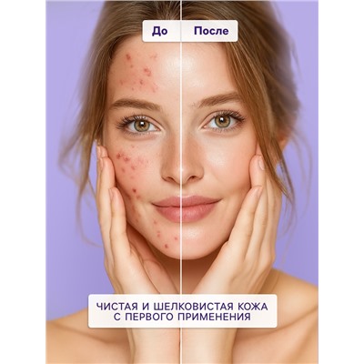 Пилинг-ПЭДЫ для лица Sendo c BHA- кислотами, обновляющие, 80 мл