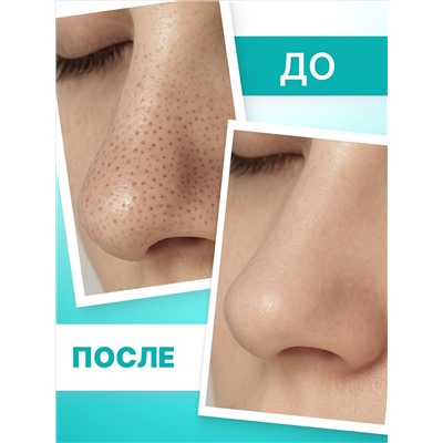 Очищающие полоски для носа TeenSkin