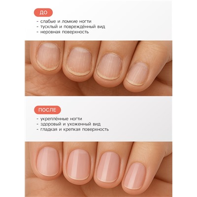 Лак-уход лечебная серия JEANMISHEL 8 в 1 мультикомплекс, 6 мл