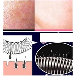 Эпилятор пружинный для лица, прибор для удаления волос