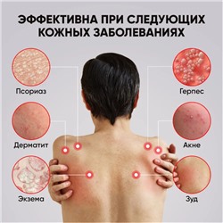 Мазь-крем от высыпаний на спине, псориаза, экземы, атопического дерматита,акне 20гр