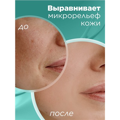 Гиалуроновая пилинг-скатка для лица HyaluronCa