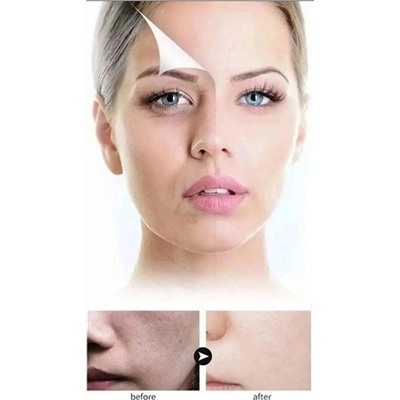 Сыворотка #23086079