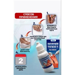 Эссенция от вросшегося ногтя ,для кутикуы, от грибка, для укрепления ногтей,20мл