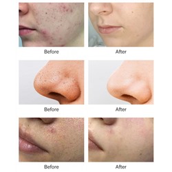 (ЗАМЯТА КОРОБКА) Обновляющий пилинг-тоник с 7% гликолевой кислоты MOOYAM Glycolic Acid 7%, 250 мл.