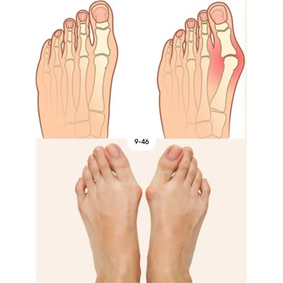 Артикул #23117550