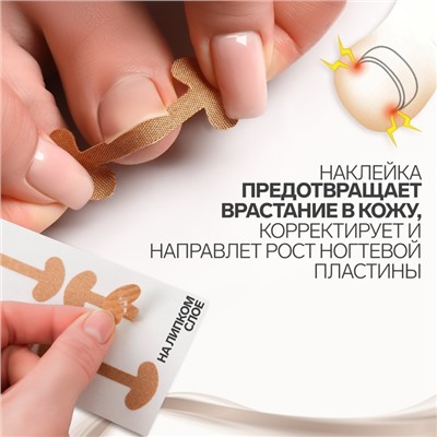 Набор наклеек для коррекции вросших ногтей, 8 шт., 5.2×2 см, бежевый