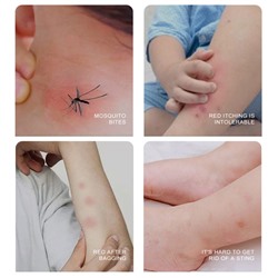 (ЗАМЯТА КОРОБОЧКА) Бальзам от укусов насекомых в стике ZOO-SON Refreshing comfrey oinment, 7,4 гр.