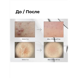 VT Cosmetics Бустер-сыворотка для лица с микроиглами и экстрактом центеллы азиатской / Reedle Shot 100, 50 мл