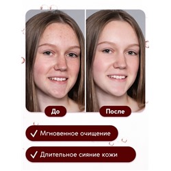 Гель для умывания очищающий SEMILY с АНА кислотами, 200 мл