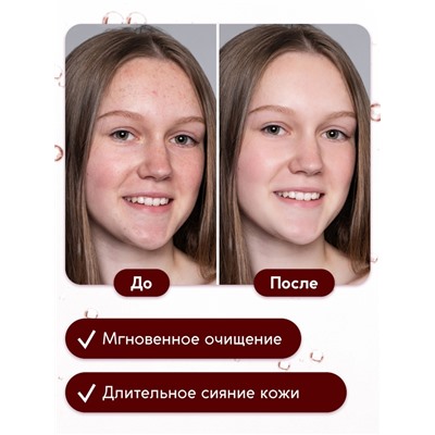 Гель для умывания очищающий SEMILY с АНА кислотами, 200 мл