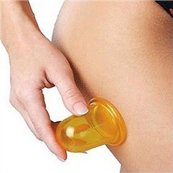 Массажная банка "Тюльпан"  2 шт.