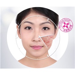 Сыворотка анти-акне с маслом Ши Bioaqua