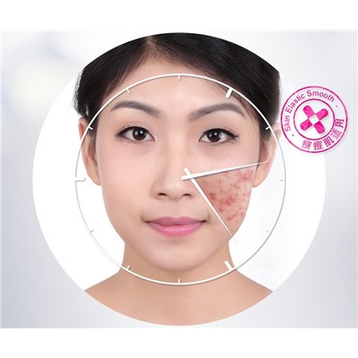 Сыворотка анти-акне с маслом Ши Bioaqua