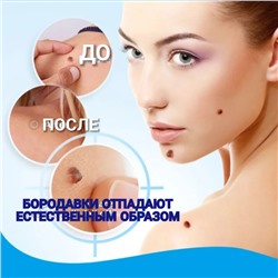 Крем для удаления бородавок, родинок и папиллом, 20 г