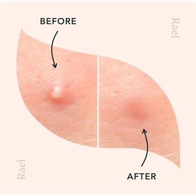 Артикул #22989155