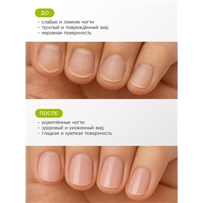 Лак-средство лечебная серия JEANMISHEL восстановление ногтей, 6 мл