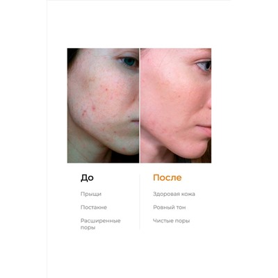 Likato Энзимная пудра для очищения чувствительной кожи и осветления следов постакне, 150 мл KRISTALLER, 1126154