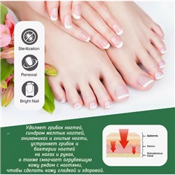 Крем для лечения грибка ногтей 30гр