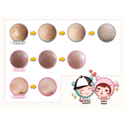 Маска для носа от черных точек Pig Nose Bioaqua