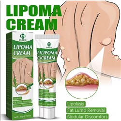 Крем Lipoma для удаления опухолей, средство для удаления отеков кожи, нодулярного дискомфорта, лечения липолиза, крем для удаления жира