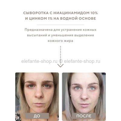 Сыворотка The Ordinary с ниацинамидом 10% и цинком 1% на водной основе, 30 мл (КО)