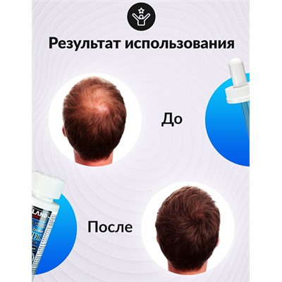 "Minoxidil Kirkland 5%" - средство для роста волос и бороды, 60 мл