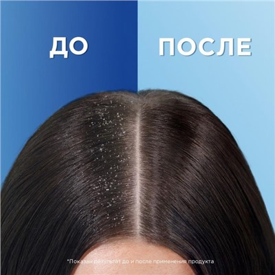 Шампунь 2 в 1 Head & Shoulders «Основной уход», 600 мл